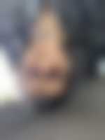 صورة العضو